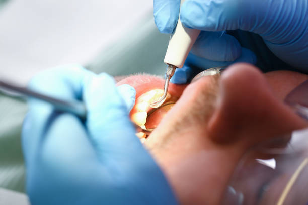 Best Emergency Pediatric Dental Care in Purvis, MS