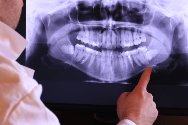 Best Urgent Dental Care for Toothaches in Purvis, MS